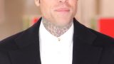 Fedez svela il mistero degli occhi neri a Sanremo 2025: ecco cosa c’è dietro