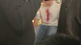 Ragazzino accoltellato al volto in piazza Poli da coetanei